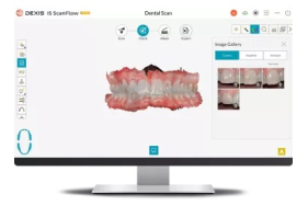 dexis-is-scanflow-check-with-intraoral-pictures_1751957627-1df76fa29e57b9f67c36b2928a73ee7a.jpg